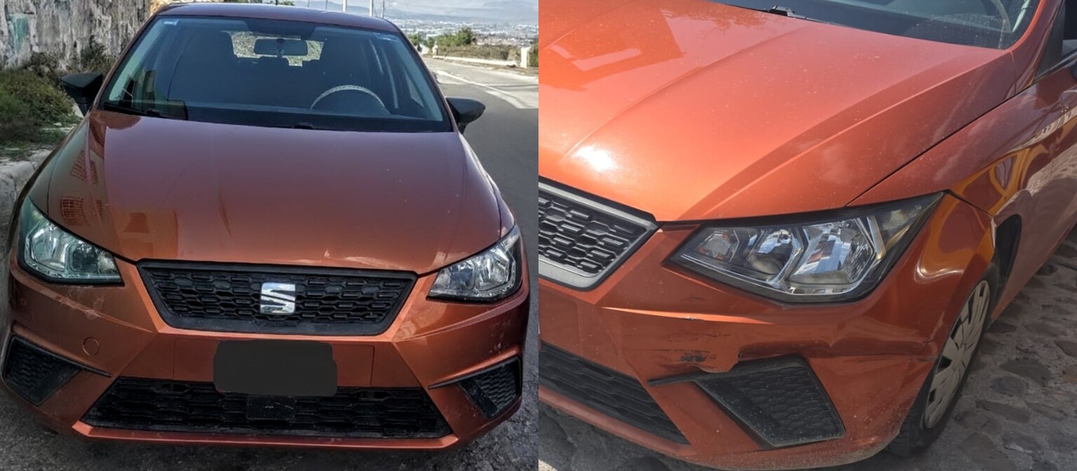 Antes y después reales compartidos por Regina Cantú tras la reparación